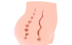 Cherry Masturbator