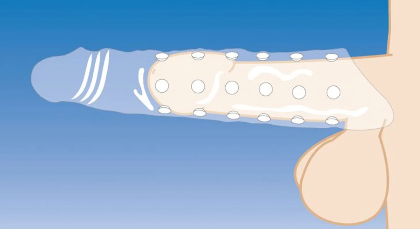 Extender Penissleeve Met Noppen - Transparant